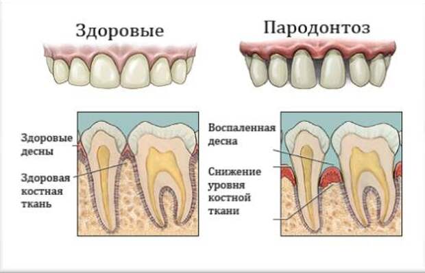 фото: https://medmanual.ru