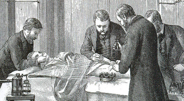 Женское обрезание: почему эта операция была популярна в Викторианской Англии