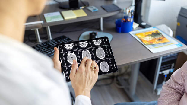 Рентгенолог Филимонова посоветовала сделать МРТ головного мозга при нарушении сна