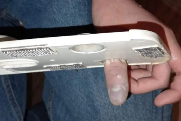 Операция «Швабра»: экипаж «Вега-2» спас палец юного жителя Новосибирска