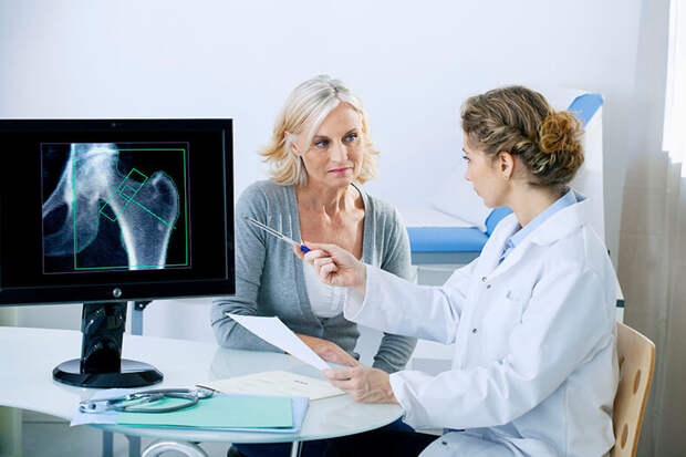 Факты, которые нужно знать об остеопорозе
