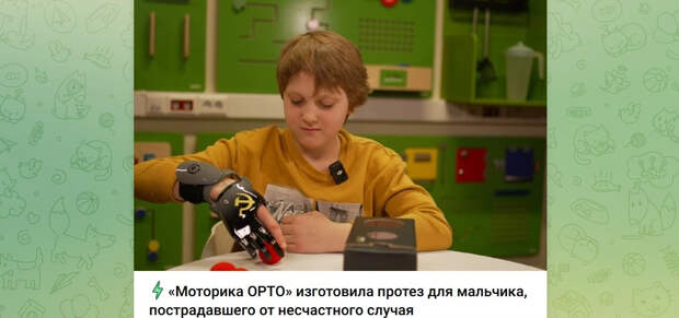 Пострадавший от взрыва мальчик из Красногорска получил протез с символикой СССР
