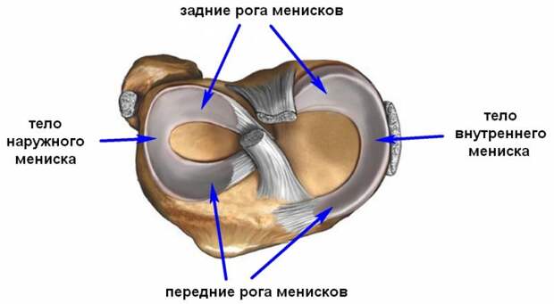 Дегенеративные изменения медиального мениска: причины, симптомы, методы лечения, профилактика