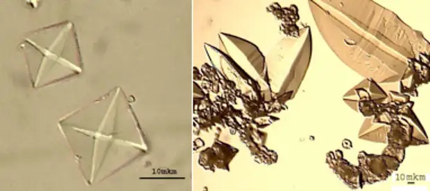 Щавелевая кислота и оксалаты в продуктах питания и в вашем теле