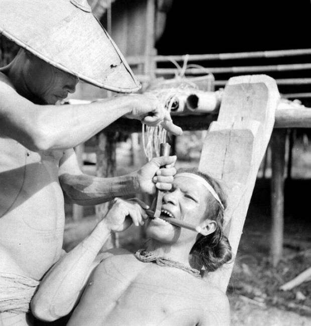 Заточка зубов у индонезийских племен, 1938 год. история, ретро, фото