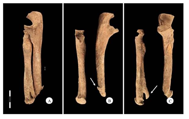 Кости правого предплечья / Journal of Anthropological Sciences