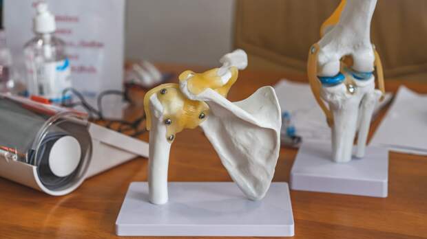 Почему болят суставы: причины, симптомы и лечение артралгии