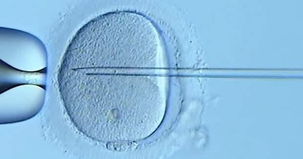Репродуктивные технологии не повышают общий риск рака у женщин — крупное австралийское исследование