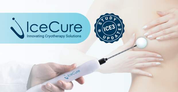 Ледяной луч надежды: как замораживание опухолей спасает от рака груди