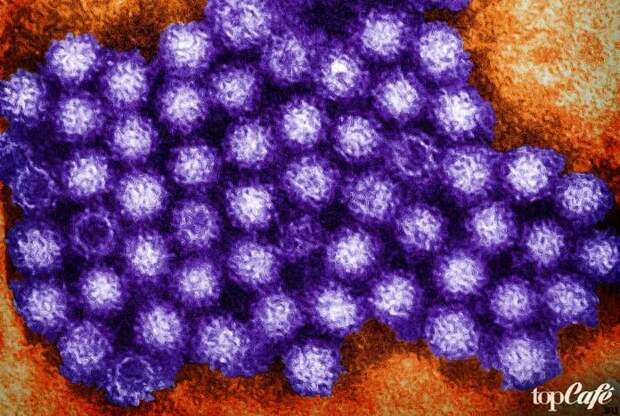 10 вирусов, которые полезны для человека: Вирус везикулярного стоматита