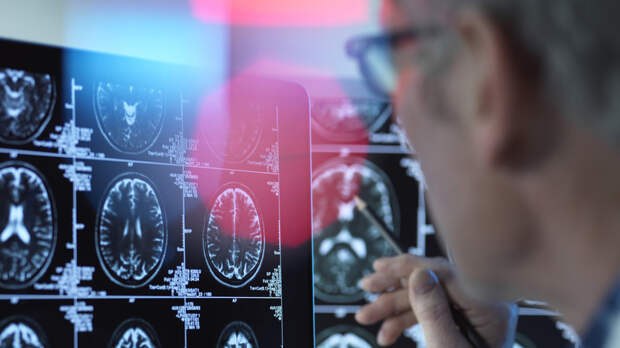 Диетолог Соломатина: регулярные переедания на ночь чреваты ранней деменцией