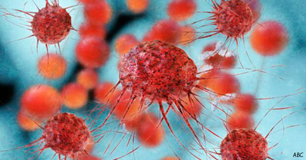 Рак легких убивает иммунотерапия! Вот как это работает