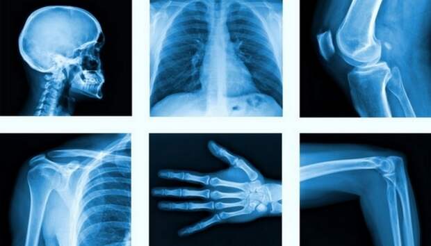 Прорыв в медицине: рентген.