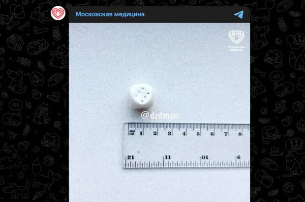 Московские хирурги спасли ребенка, проглотившего игральный кубик