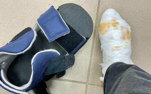 С начала 2026 года 16 рязанских детей получили травмы при катании на тюбинге