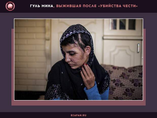Гуль Мина, выжившая после «убийства чести»