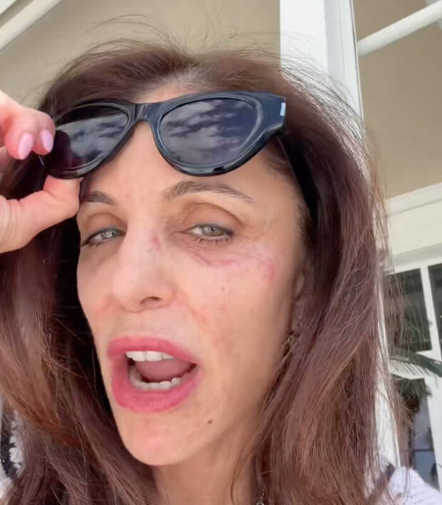 Отдых в роскошном отеле на Сен-Барте обернулся инфекцией для звезды реалити-шоу