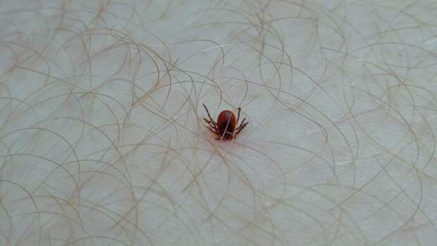 Тулякам напомнили симптомы клещевого энцефалита