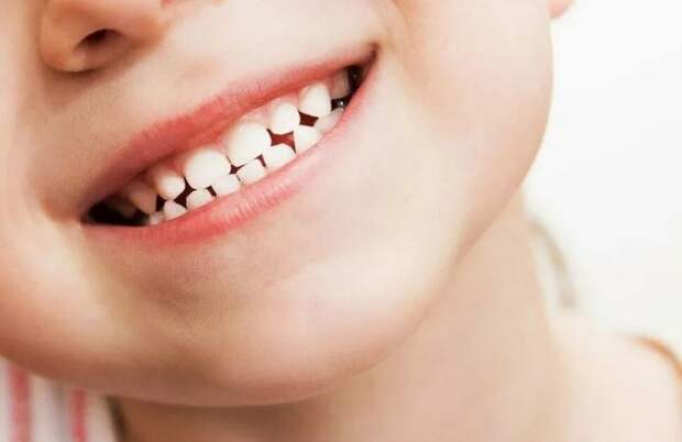 Загадочная болезнь, распространенная у детей. Сначала мать Алекса думала, что проблема в его зубах — оказалось, что нет. Загадочная болезнь, распространенная у детей. Сначала мать Алекса думала, что проблема в его зубах — оказалось, что нет. Фото.