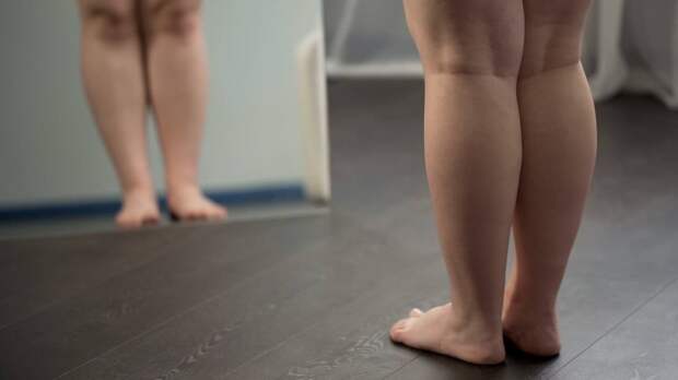 Женщина похудела на 63 килограмма и приняла радикальное решение о личной жизни