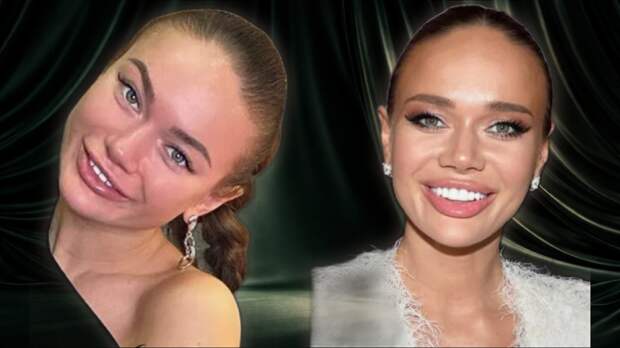 За гранью гламура: 9 российских актрис, чьи лица без макияжа «меняются до неузнаваемости»