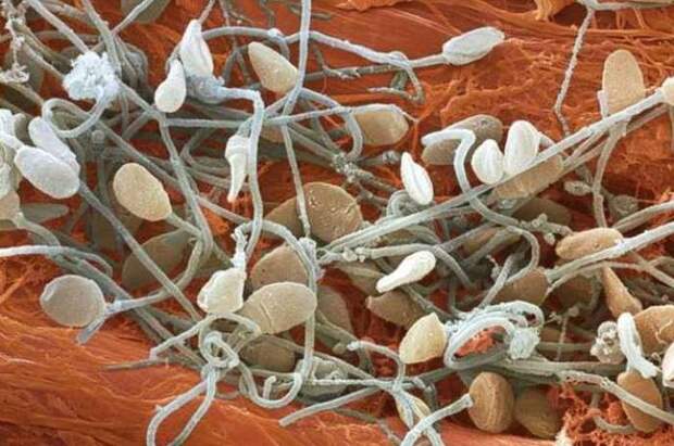 15. Сперма организм, под микроскопом