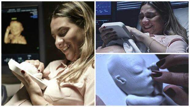 4. Матери могут потрогать 3D-модель ребенка еще до того, как он родился будущее, в мире, гаджеты, люди, наука