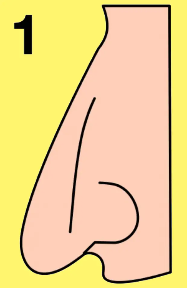 горбинка перед кончиком носа. нубийский нос. безоперационная ринопластика. колумелла носа ринопластика. безоперационная ринопластика носа.