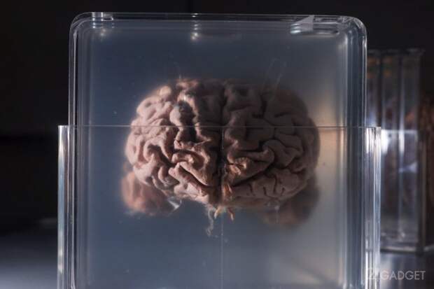 Nectome предлагает бессмертие через заморозку мозга и переноса сознания в облако (4 фото)