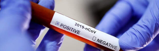 В Казахстане за ночь выявили 41 новый случай заражения коронавирусом