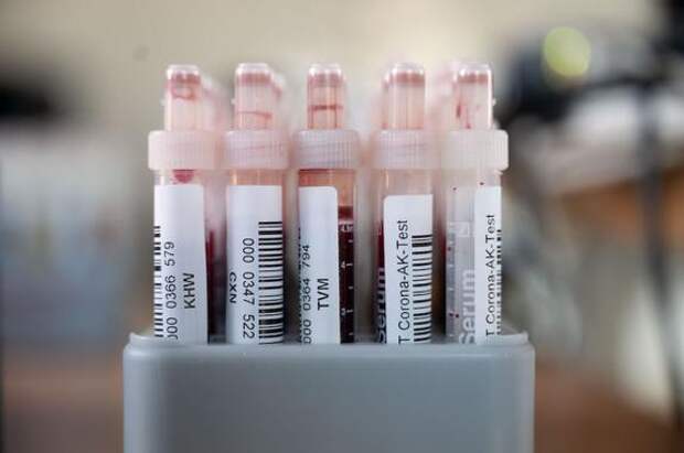 В России за сутки выявили 17 378 случаев заражения COVID-19