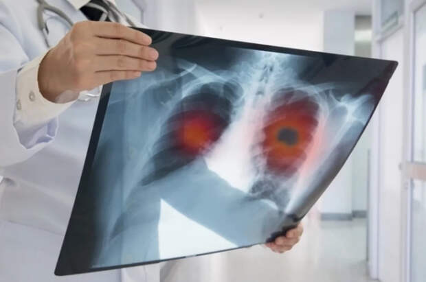 Эксперт Айсанов дал советы россиянам с одной из самых смертоносных болезней