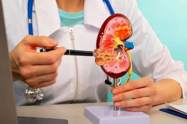 Ученые выявили связь COVID-19 с тяжелым поражением почек