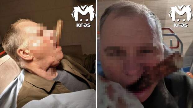 Черенок лопаты пронзил шею жителю Красноярска и вышел через рот при падении с крыши