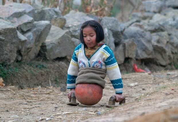 Девочка с баскетбольным мячом вместо ног стала известной спортсменкой девочка, дети, инвалид, китай, мотивация, плавание, протезы, спорт