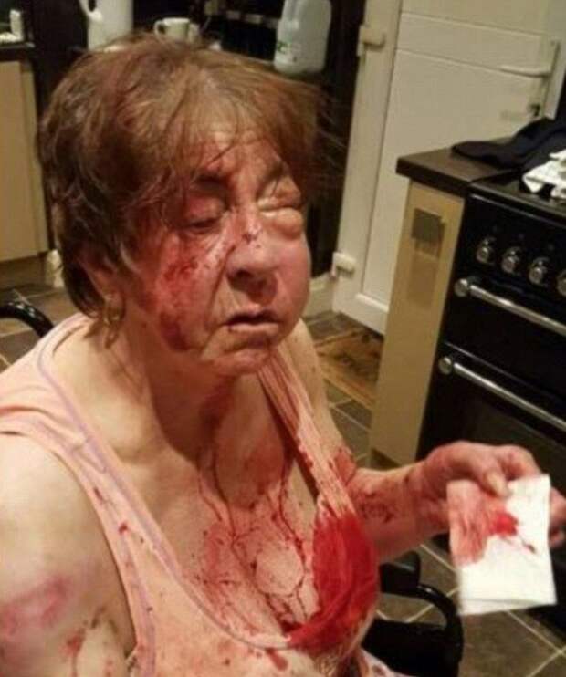Старушке изрядно досталось от дилеров за сына, который набрал травки на сотню фунтов