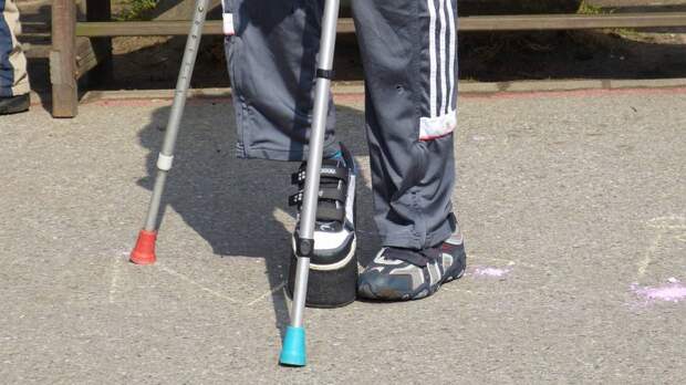 Волонтеры «Фабрики добрых дел» нашли костыли сломавшему ногу мальчику в Вологде