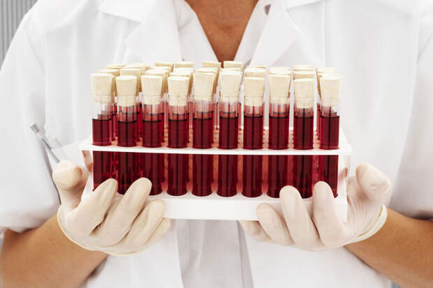 3. Смена всех групп крови на универсальную O(I) Rh-. будущее, наука, технологии