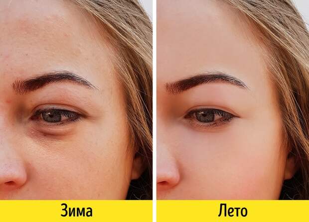 7 зимних факторов, из-за которых мы выглядим старше