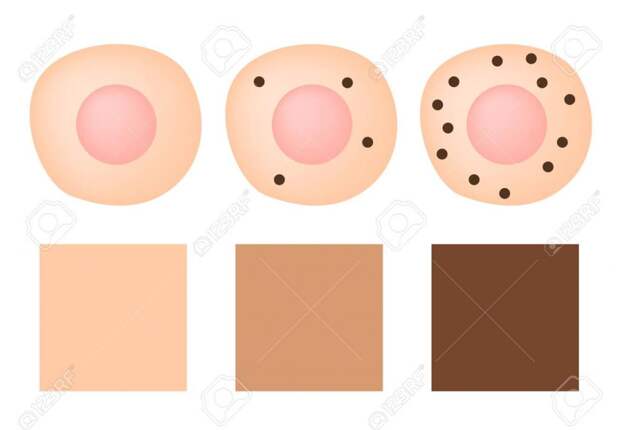 Пигмент или кровеносные сосуды: ученые объяснили, откуда берутся родимые пятна