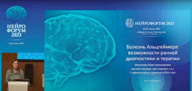 Старение мозга и нейродегенерация: возможности терапии