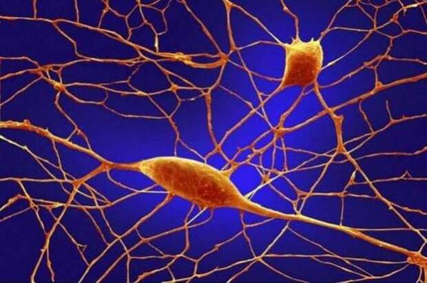 10. Нейроны мозга  организм, под микроскопом