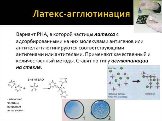 Реакция латекс-агглютинации ротавируса