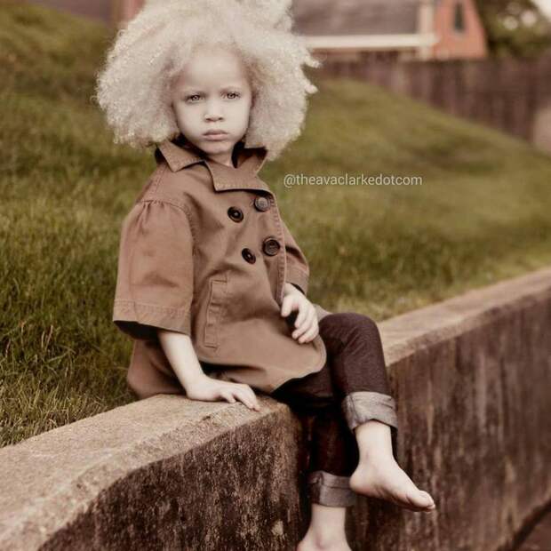 Афроамериканская девочка-альбинос покоряет мир моды