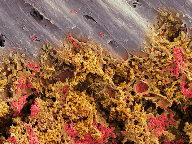 Костный мозг под микроскопом