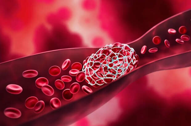 Смерть в эфире: кардиолог назвал роковую ошибку, убивающую молодых