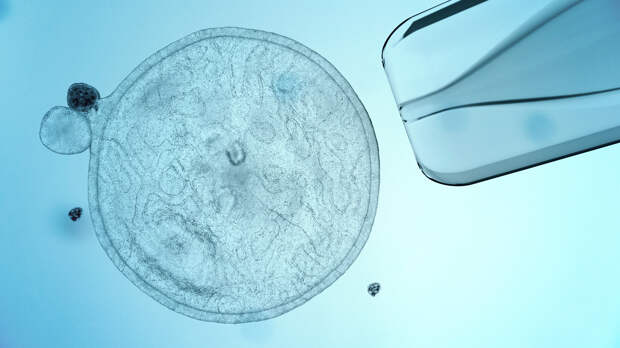 Стволовые клетки: что они могут и какие надежды на них возлагают