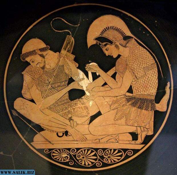Ахилл перевязывает раненого Патрокла.  Изображение из города этрусков Вульчи, 500 год до н. э.