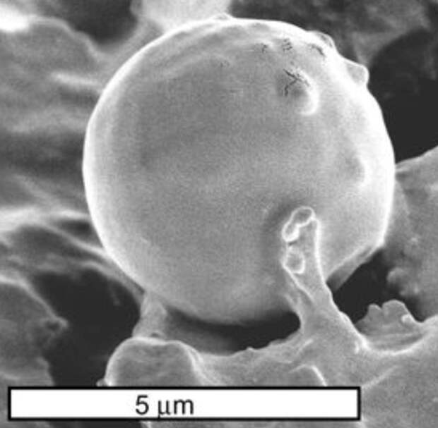 Рис. 2. Возможная симбиотическая коккоидная водоросль у прототаксита Логана (Prototaxites loganii)