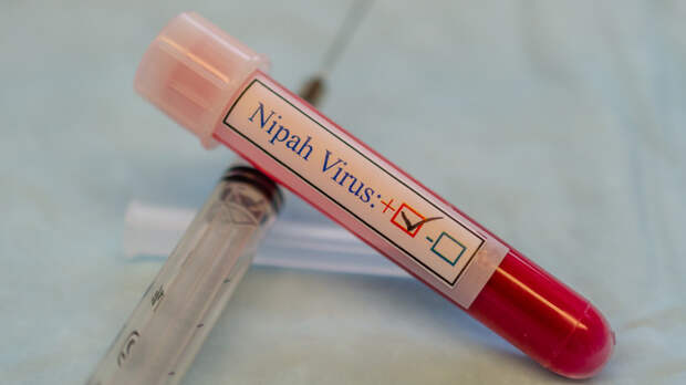 ВОЗ: заболевание вирусом Нипах может протекать бессимптомно